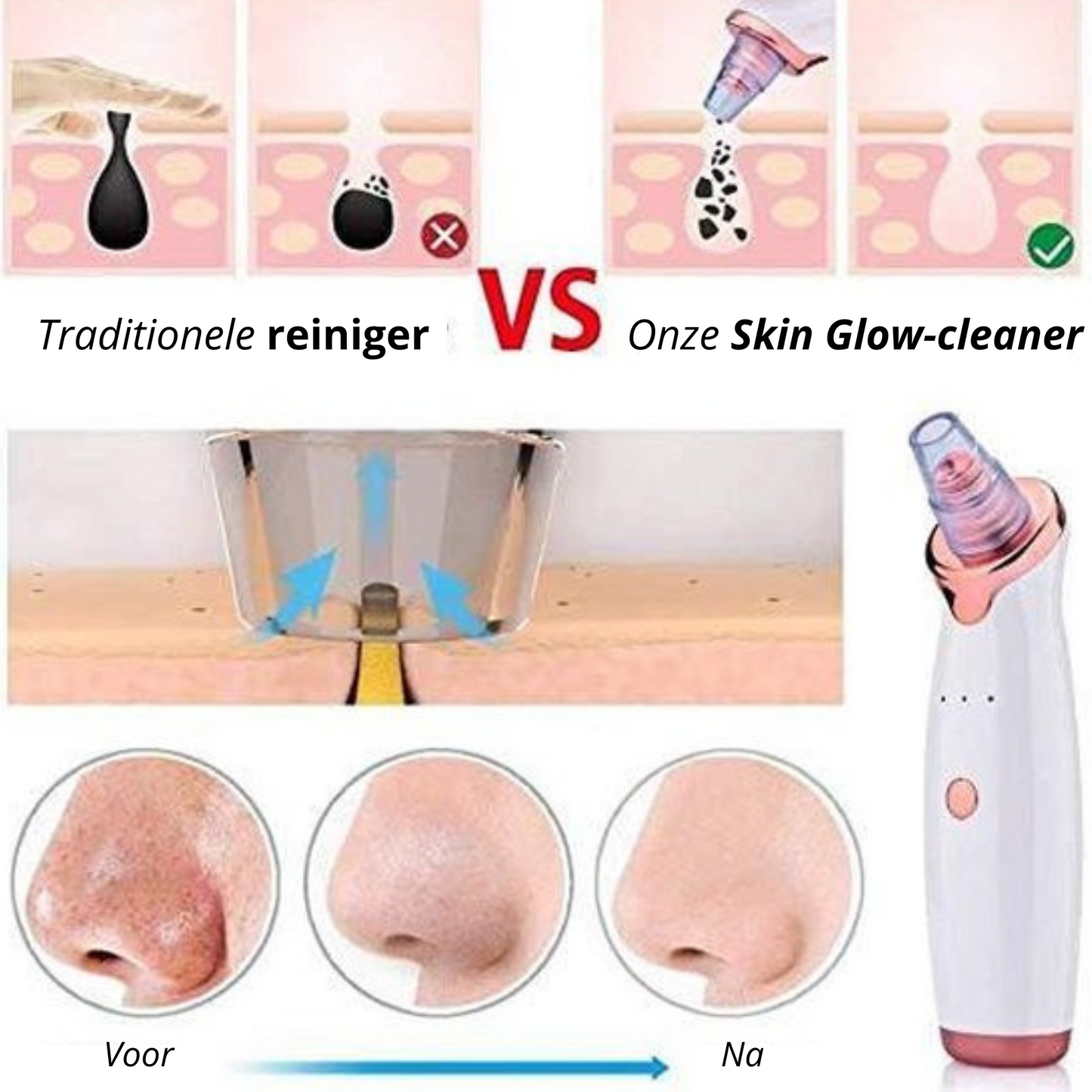 SkinGlow Cleaner - Zeg Vaarwel Tegen Onzuiverheden